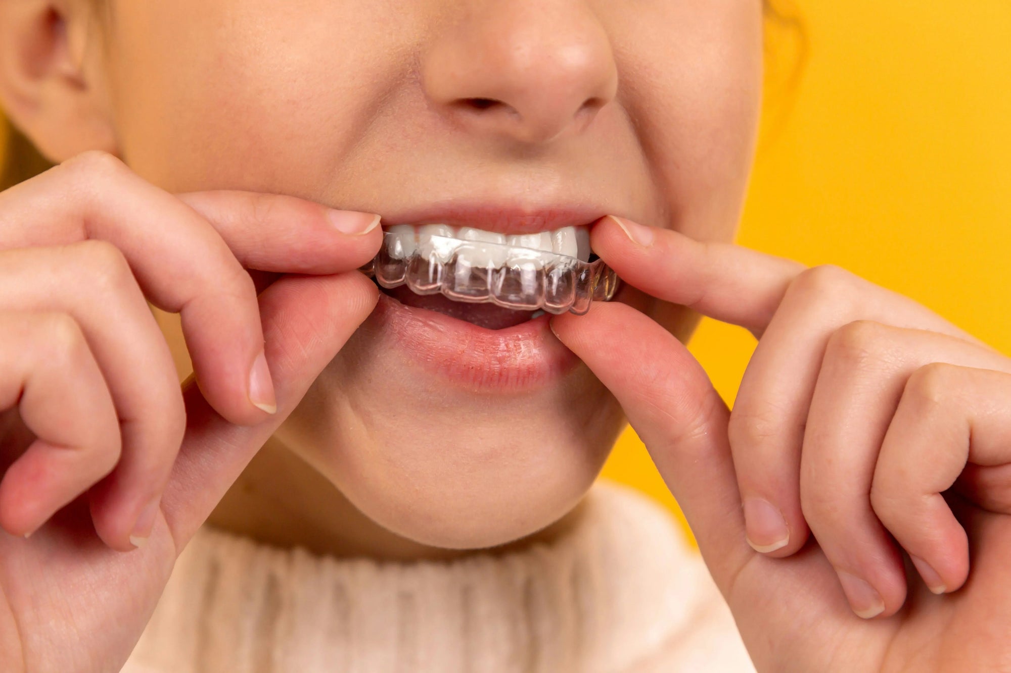 Clear Retainers vs. Wire Retainers: Which One Is Right for You?